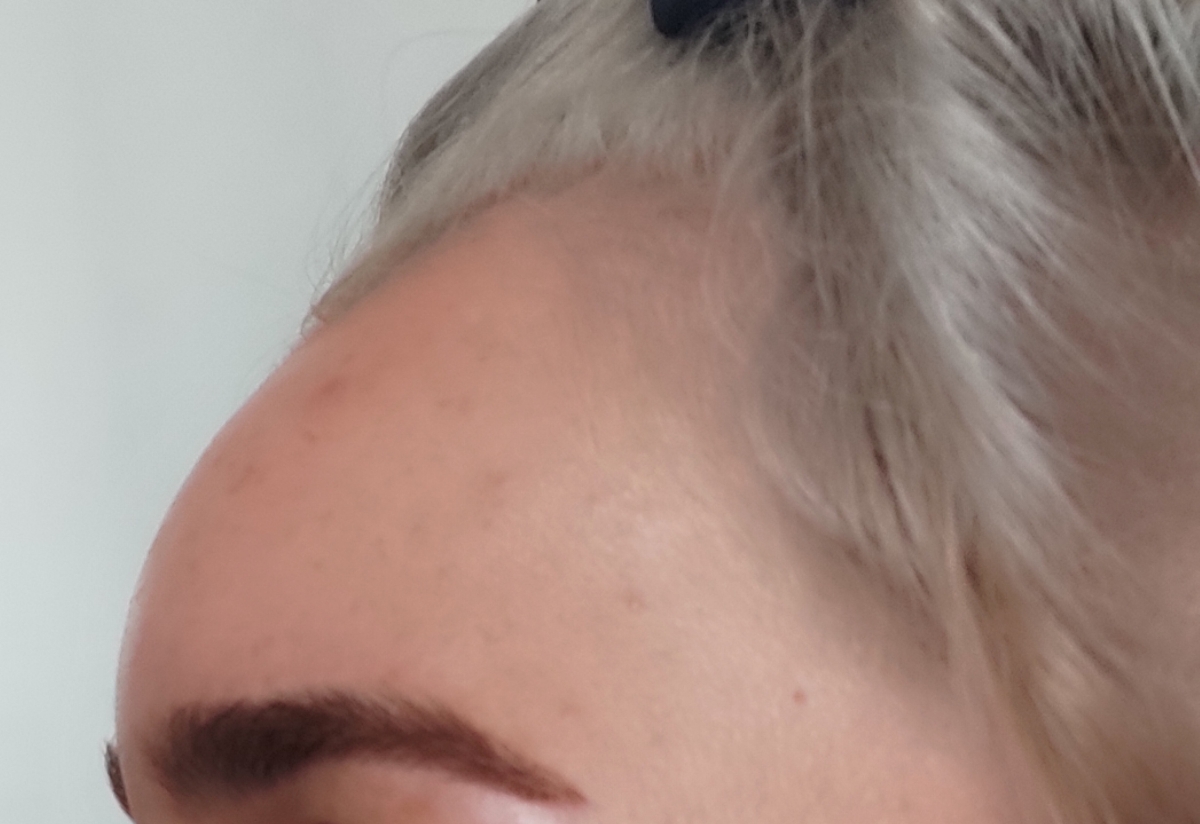 پف پیشونی منو ببینین فقط من پیشونیم صافه صافه پف پیشونی منو ببینین فقط من پیشونیم صافه صافه