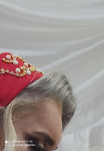 حتی بامیکاپ پیدا بود اینقدر زیاد بود پشت ابروم گود شده حتی بامیکاپ پیدا بود اینقدر زیاد بود پشت ابروم گود شده