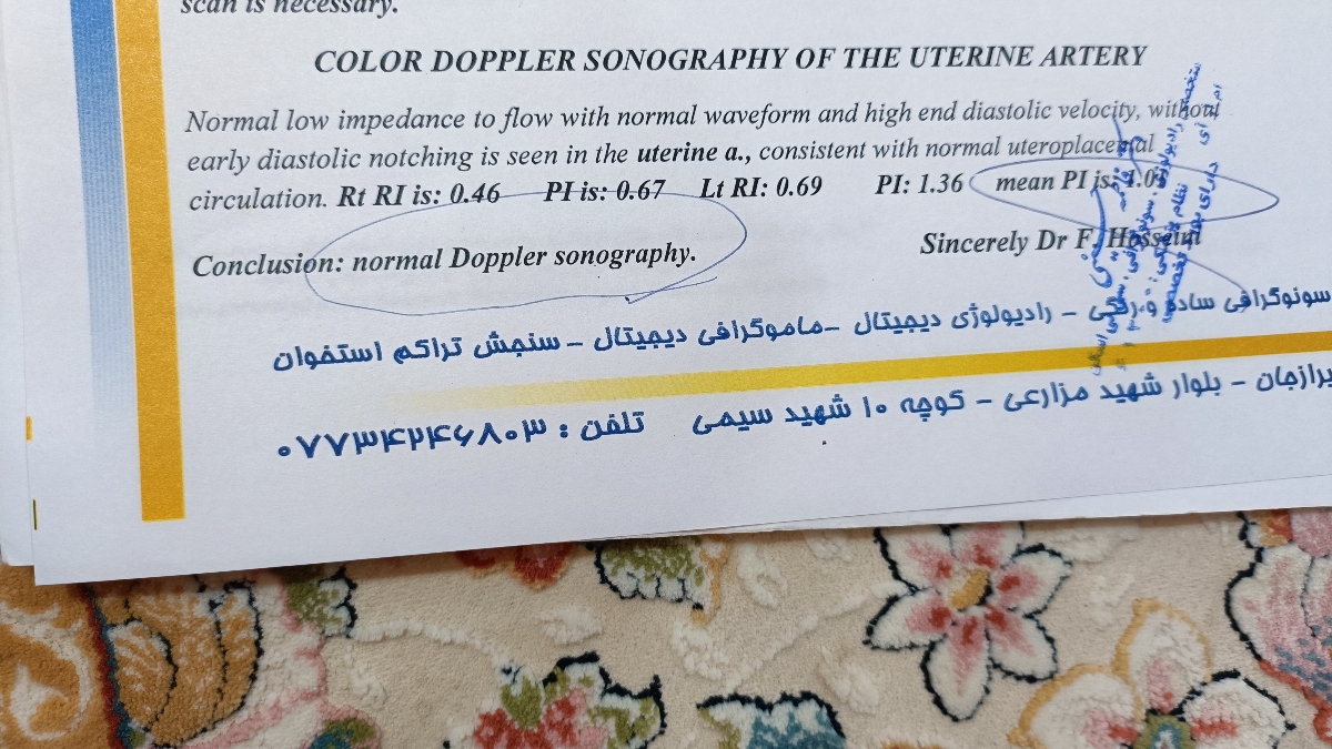 پیچ خوردن بند ناف دور گردن جنین