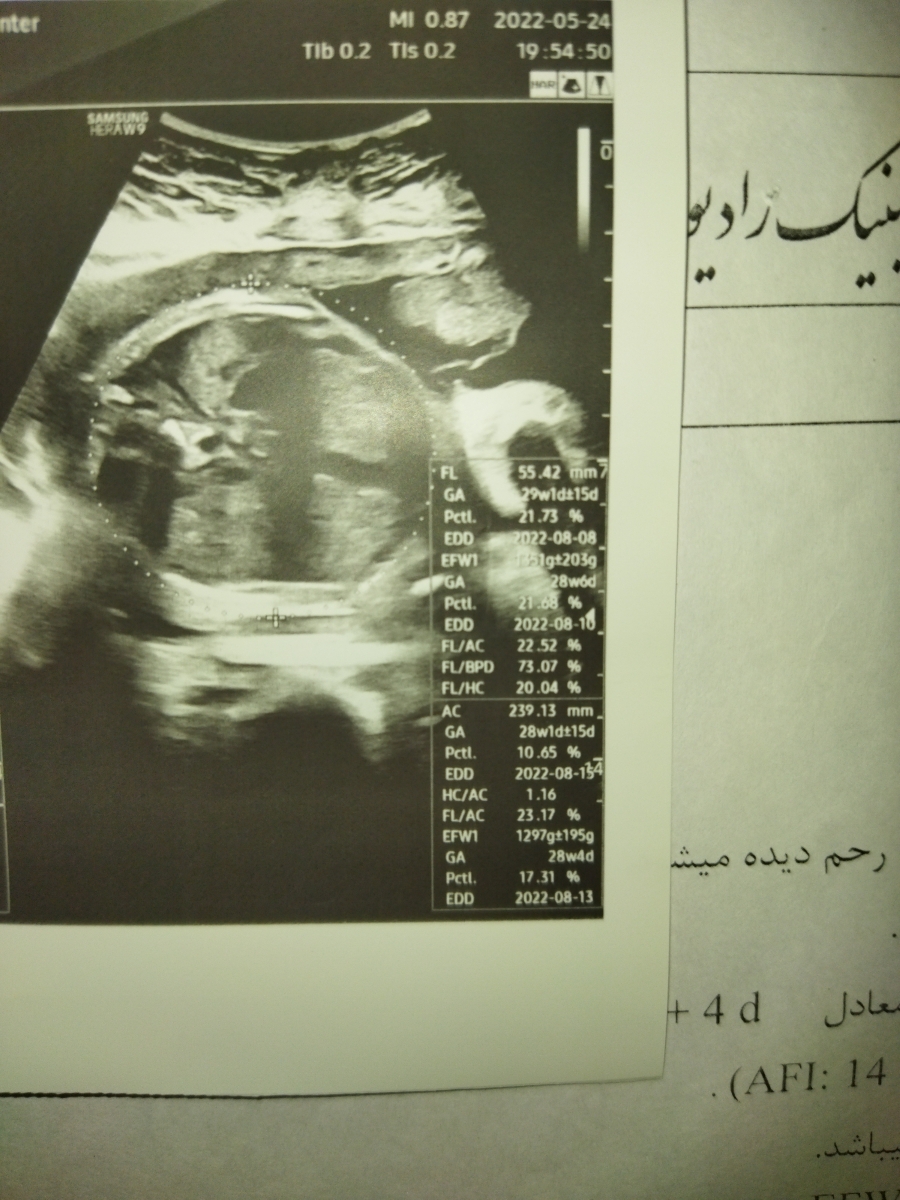 تفسیر سونو ۳۴هفته بارداری