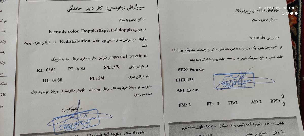 وزن کم جنین هفته سی