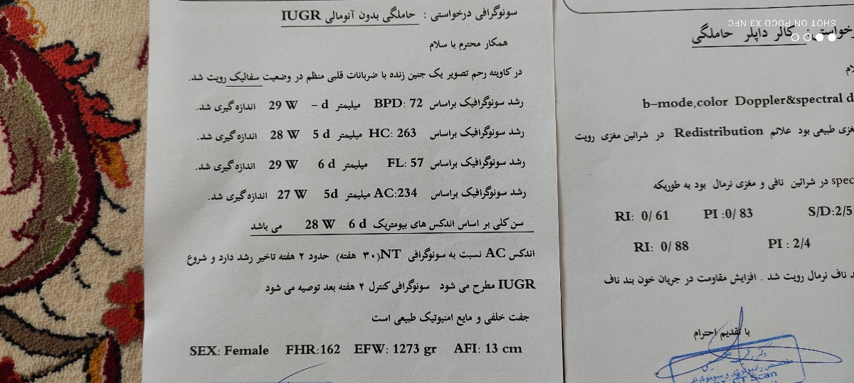 وزن کم جنین هفته سی