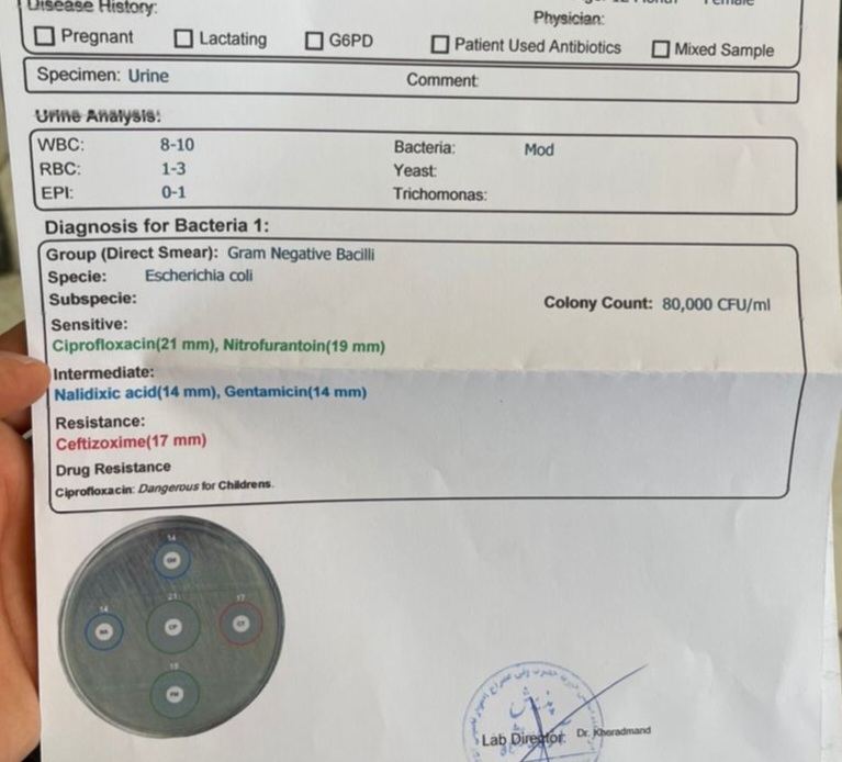 آزمایش کشت ادرار کودک
