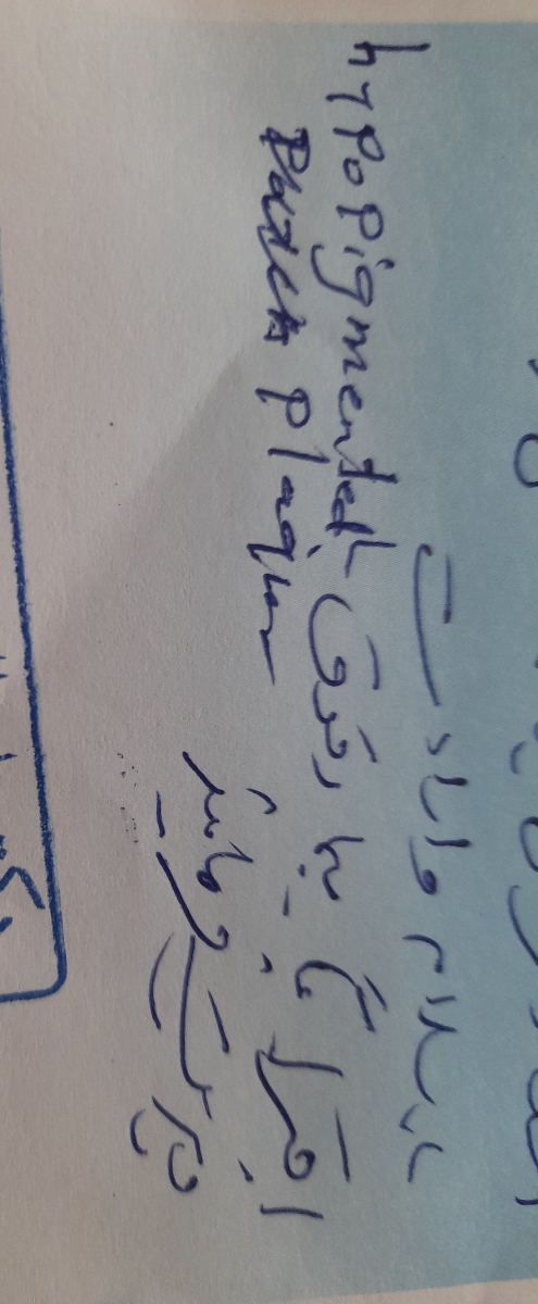ایجاد لکه های سفید