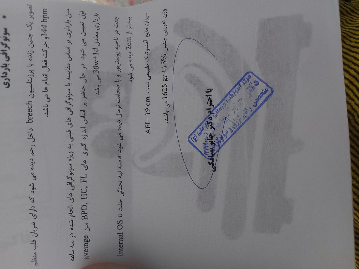 وزن نی نی هاتون چقدر بود بچه هاا