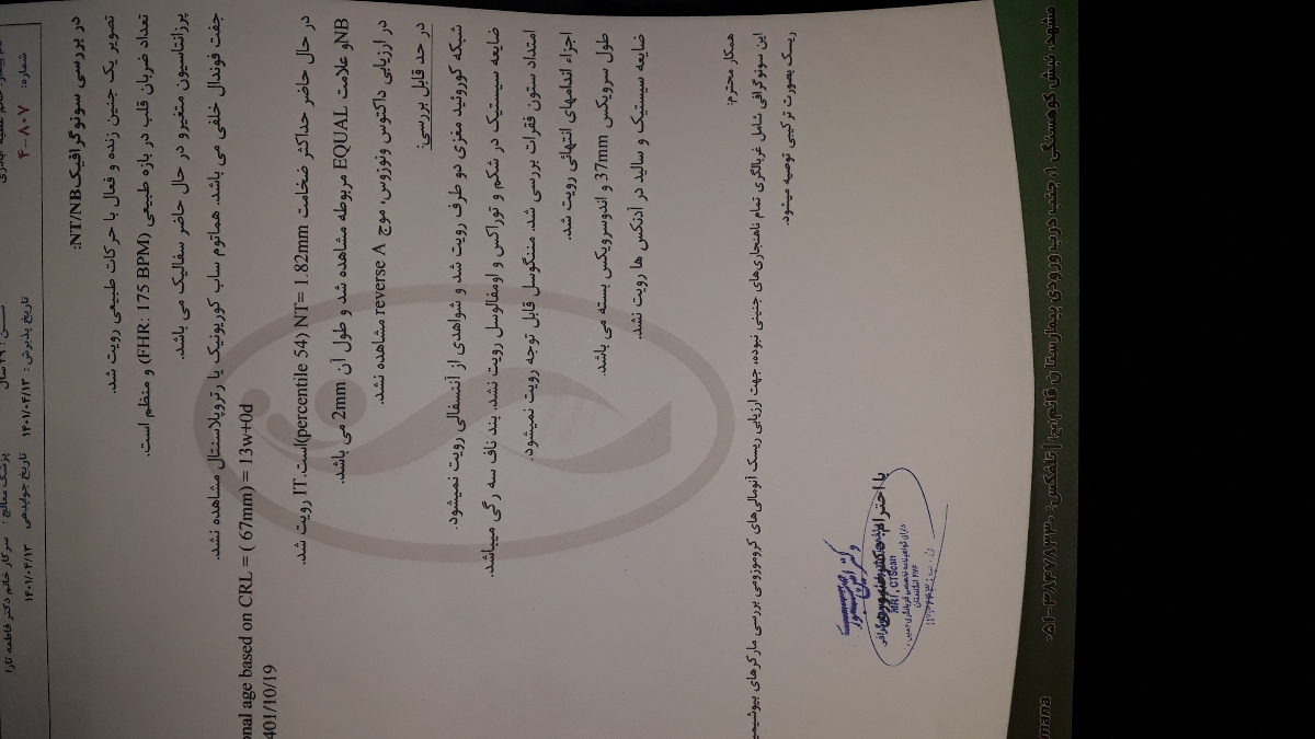 سلام لطفا سونو ان تی رو ببینید خوبه