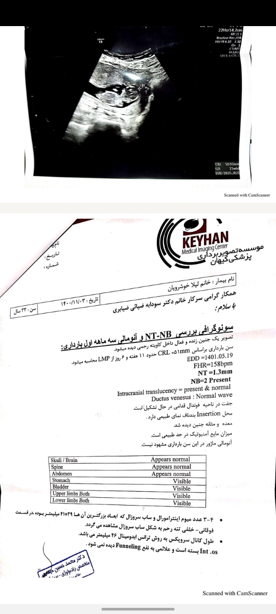 تفسیر سونوگرافی هفته ۳۵