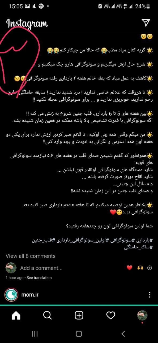 آیا سونو ساک واجبه؟