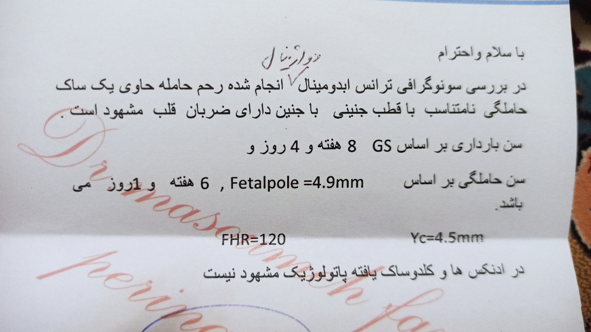 اینم از سونو 