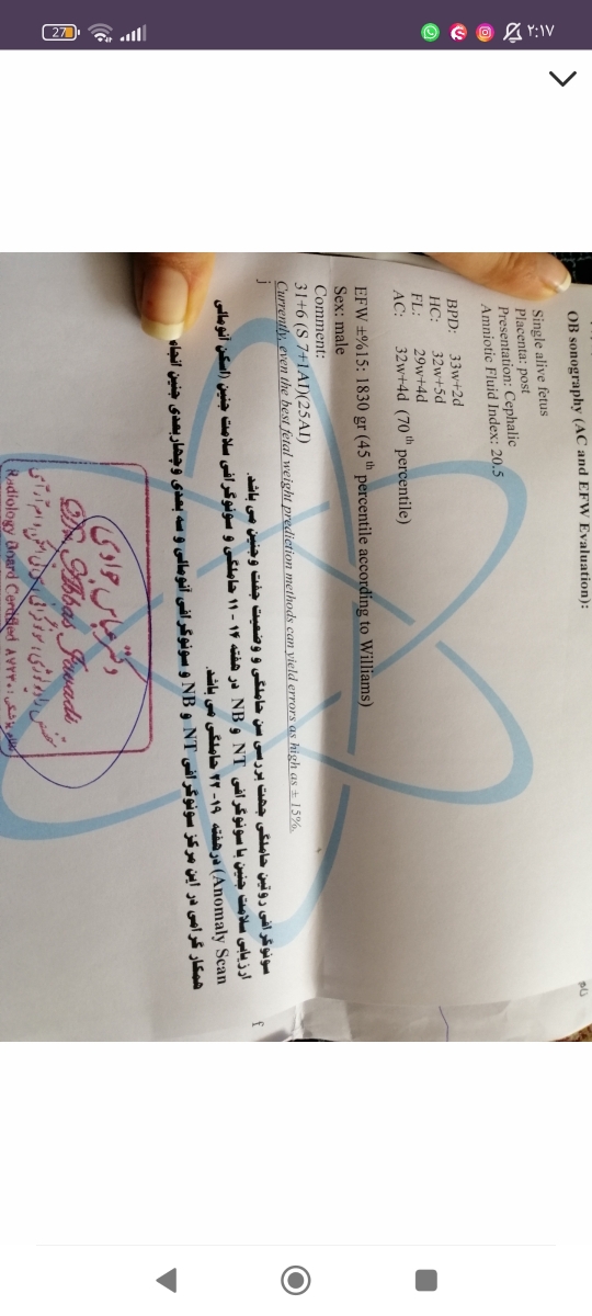 اینم سونو دوسال پیشم سر پسرم حامله بودم