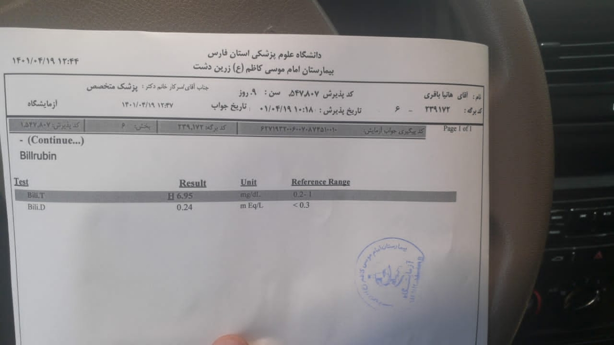 زردی نوزاد ۹ روزه