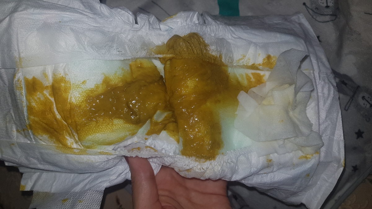 خاتم دکتر مدفوع دخترم سبزه و حالت لزج داره اسهال شده؟