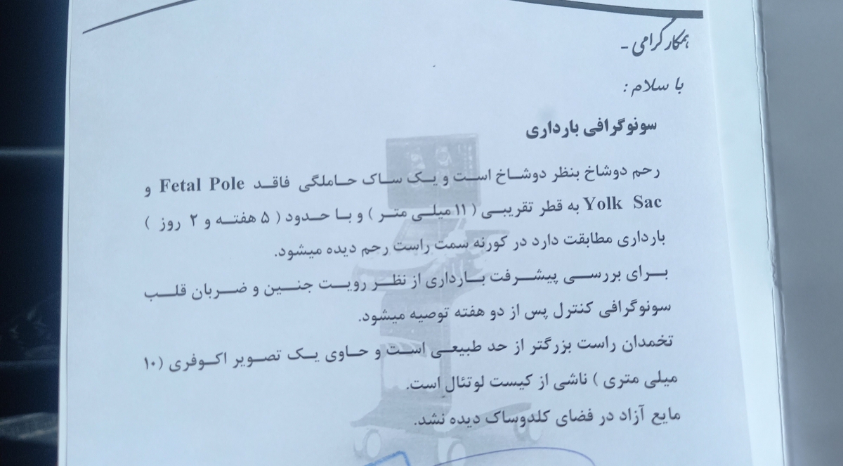 این سونو ۸تیر