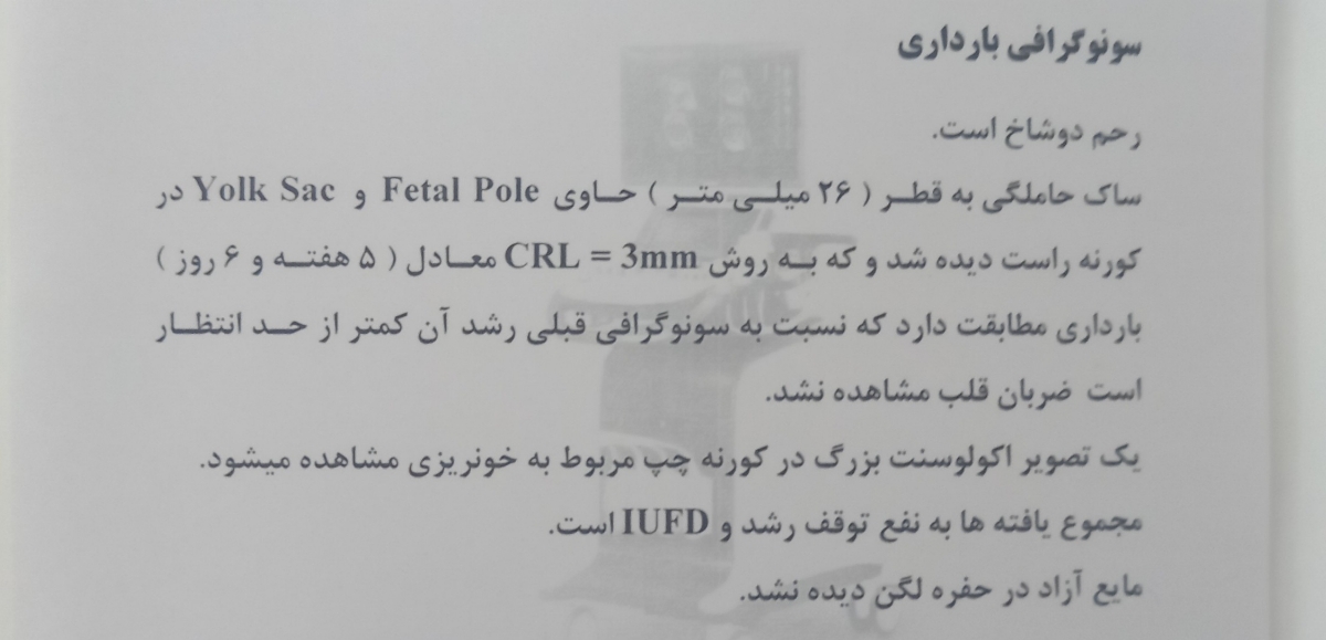 اینم سونو امروز