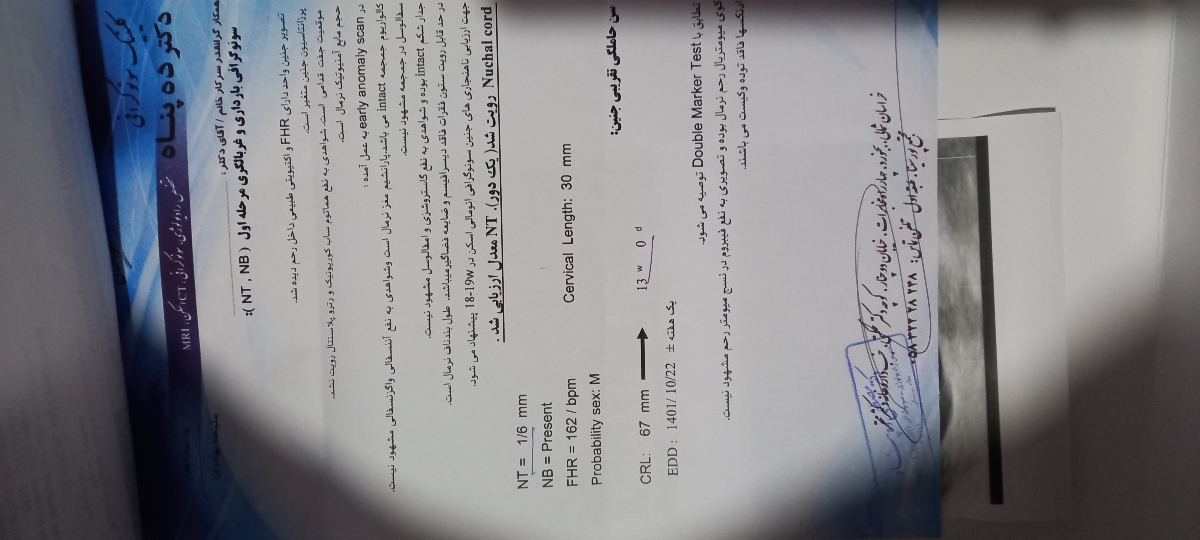 سوالم در مورد سزارین دومه