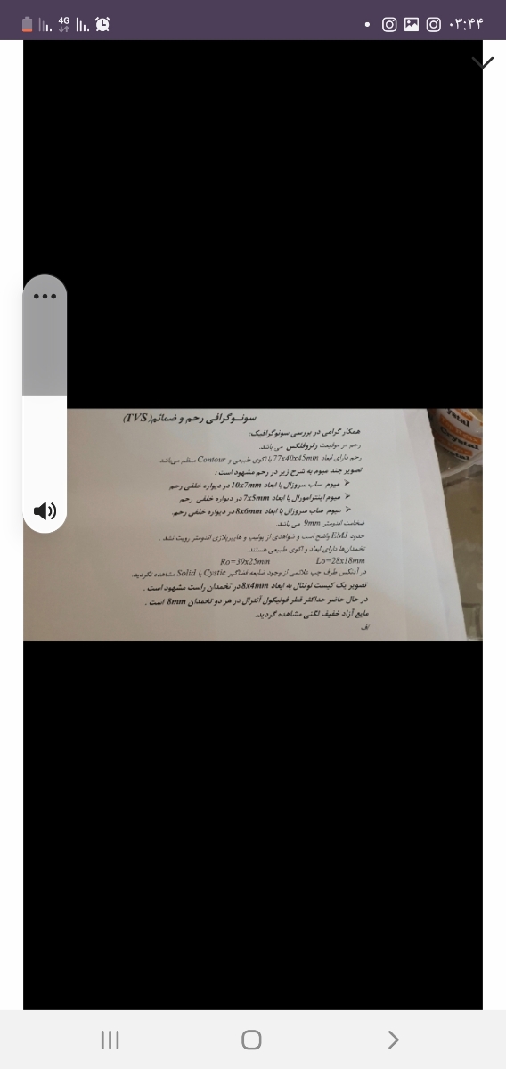 قطر فولیکول آنترال چه مقدار باید باشد