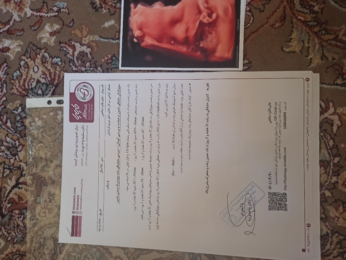 سنوگرافی وزن جنین در هفته ۳۲