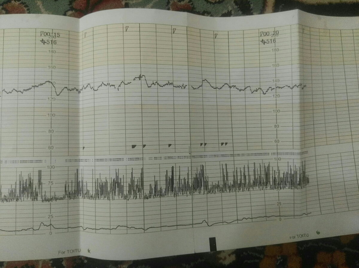 جواب نوار قلب بچه رو میشه بررسی کنید تشکر