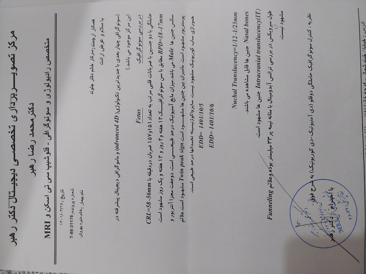 اینم سونو ان تی