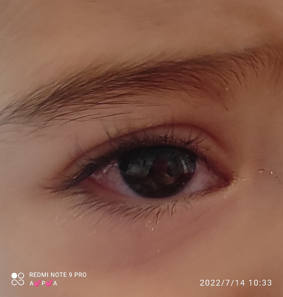 پسرم همش چشاشو میماله