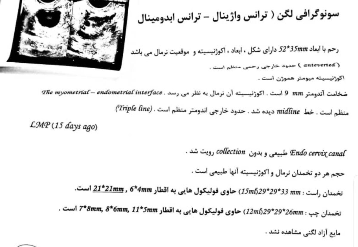 این سونو رو امروز که روز ۱۵ سیکله انجام دادم فک میکنین کی تخمک ازاد شه؟