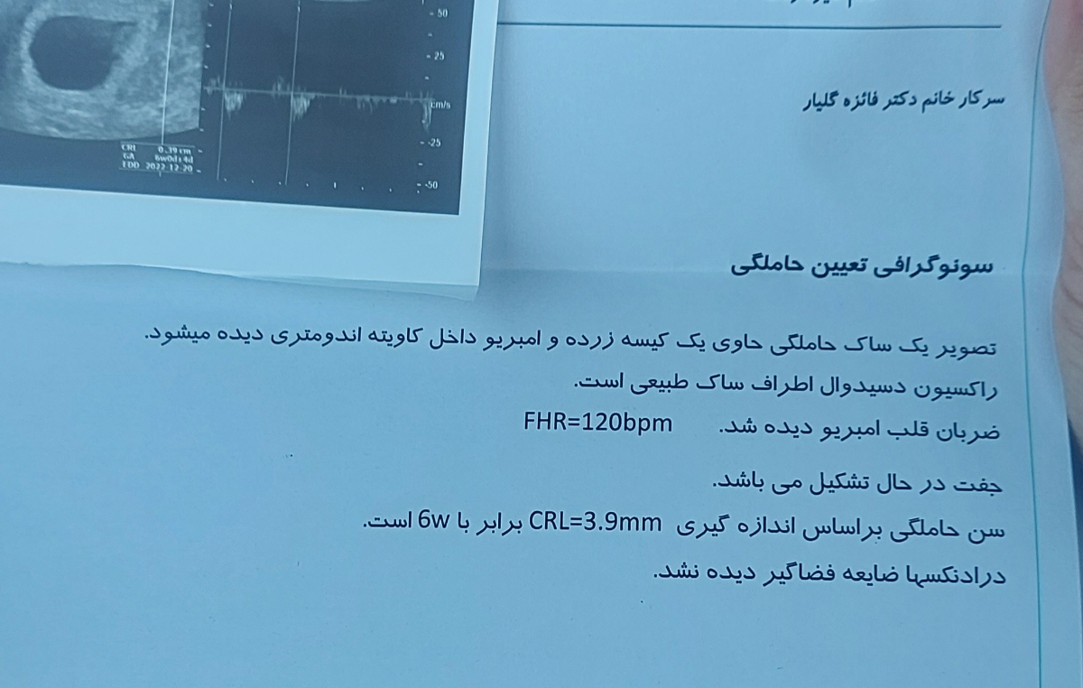 ضربان قلب ۱۲۰bpm با سن ۶ هفته ضربان قلب ۱۲۰bpm با سن ۶ هفته