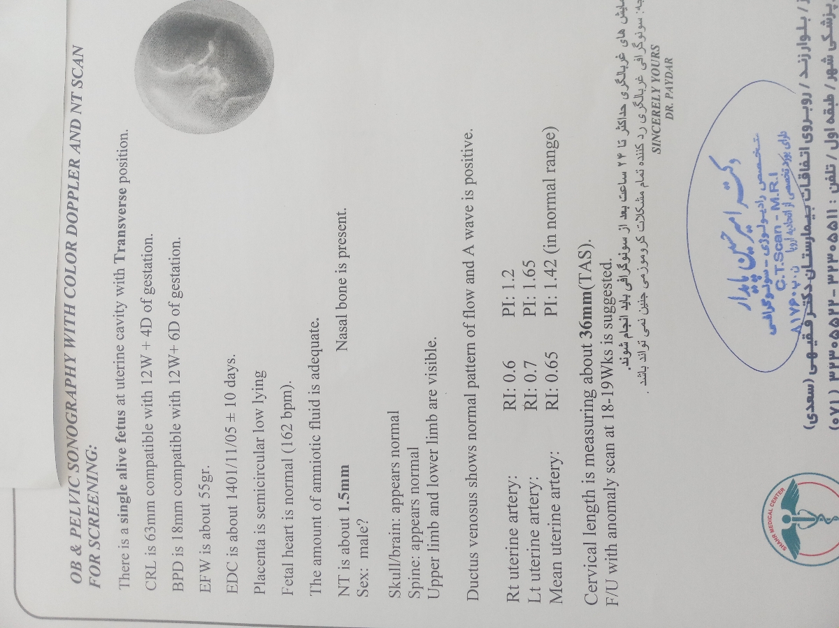 تفسیر سونو ان تی