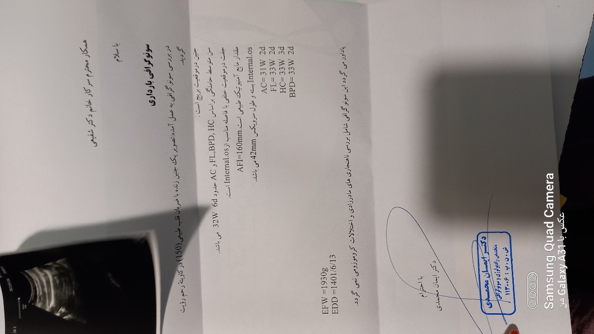 سلام سونوگرافی ۳۳ هفتگی سلام سونوگرافی ۳۳ هفتگی