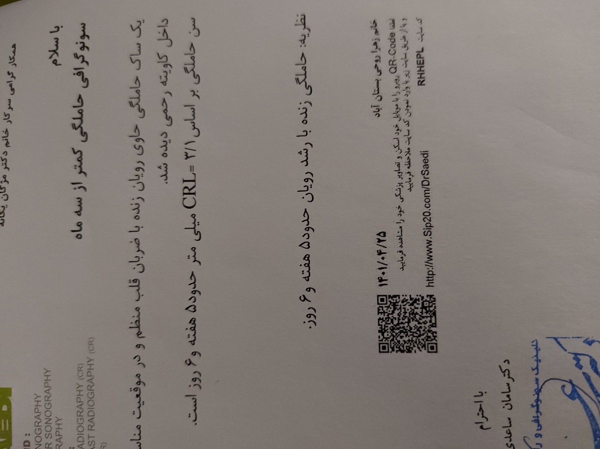 بارداری ناخواسته ولی به چشم هدیه خدا