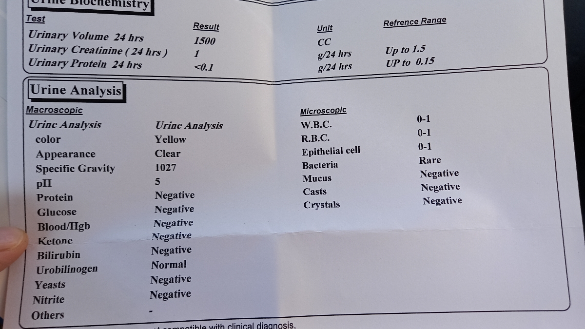 تفسیر ازمایش ادرار ۲۴ساعته