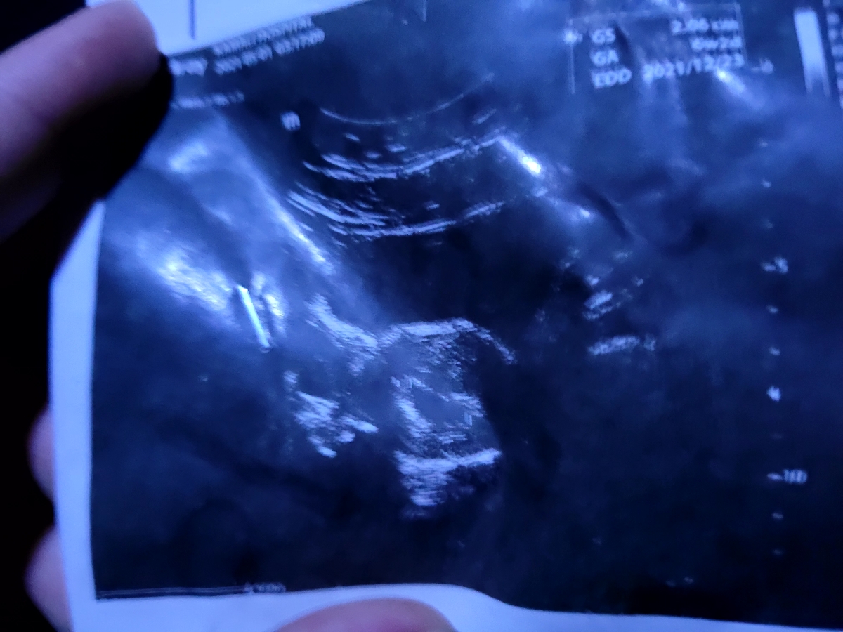 خانوم دکتر لکه بینی دارم ++عکس***