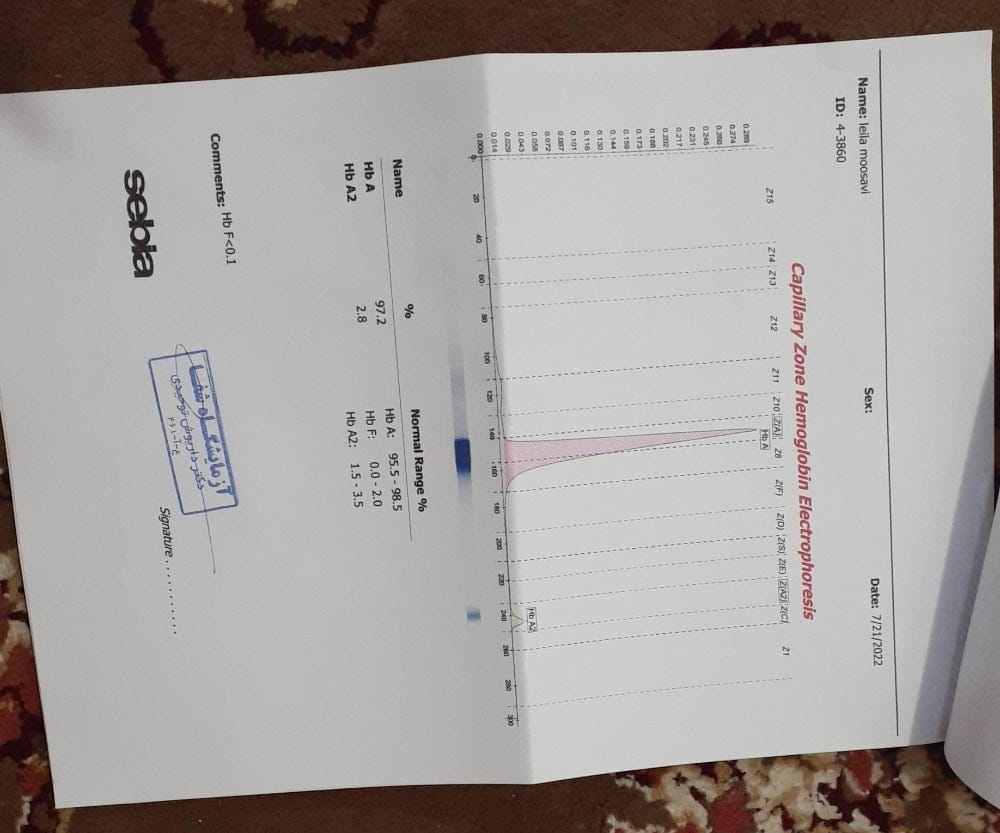 تفسیرجواب آزمایش کم خونی برای ازدواج تفسیرجواب آزمایش کم خونی برای ازدواج