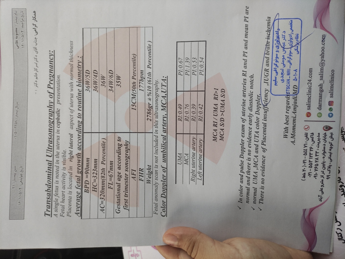 سونو سیو پنج هفته