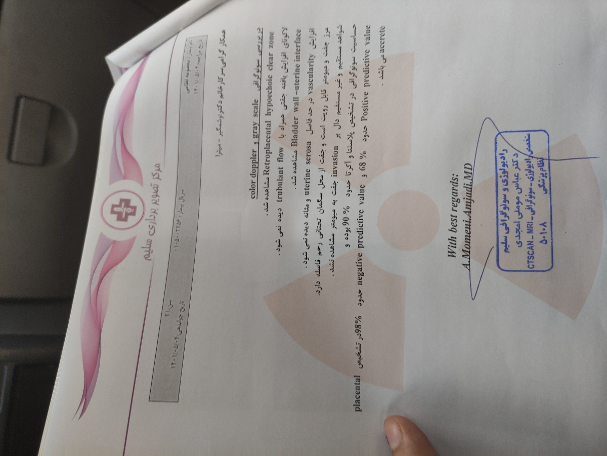 سونو سیو پنج هفته