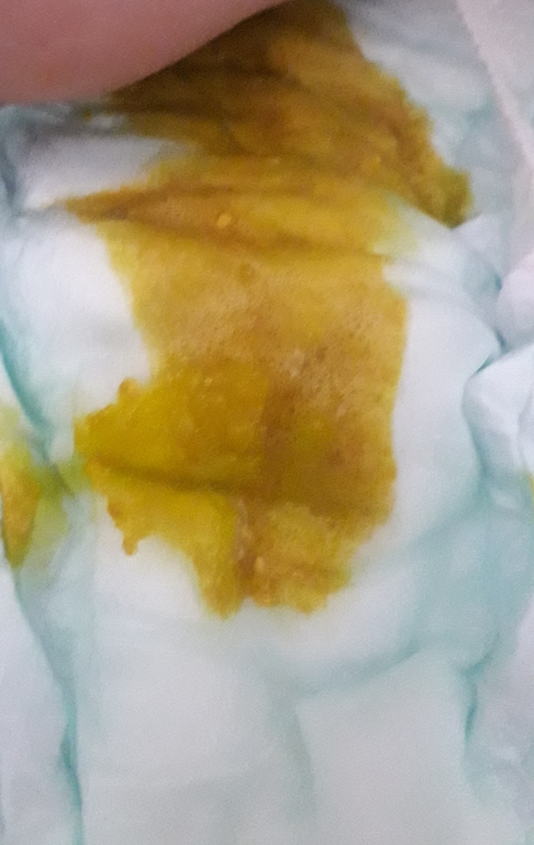 اسهال نوزاد ودیدن ازمایشات توسط پزشک محترم اوما اسهال نوزاد ودیدن ازمایشات توسط پزشک محترم اوما