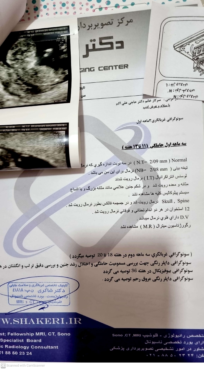 آزمایش غربالگری اول. سونوگرافی ۱۲ هفته آزمایش غربالگری اول. سونوگرافی ۱۲ هفته