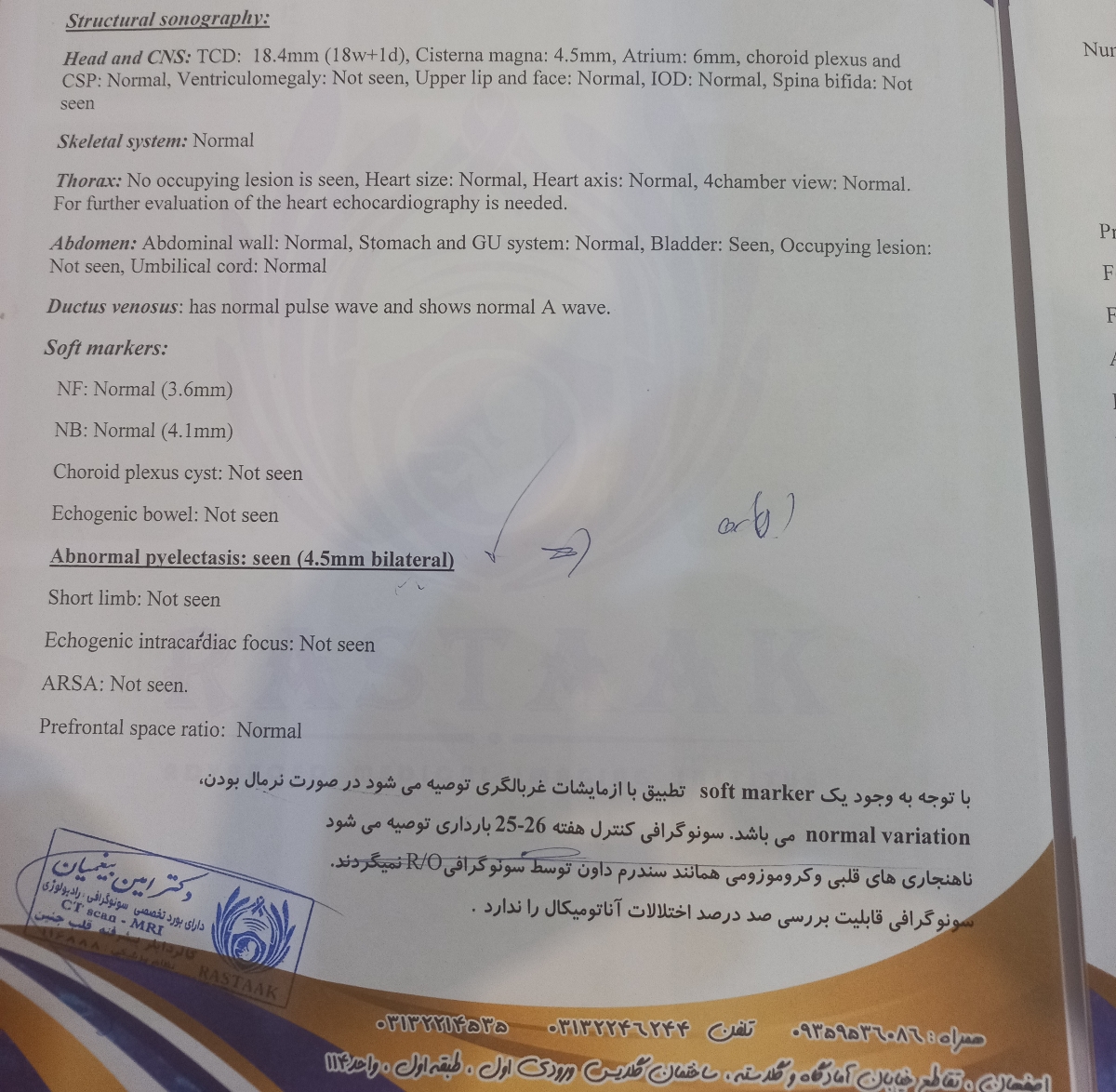 نشان دادن ادرار داخل کلیه جنین در غربالگری آنومالی نشان دادن ادرار داخل کلیه جنین در غربالگری آنومالی