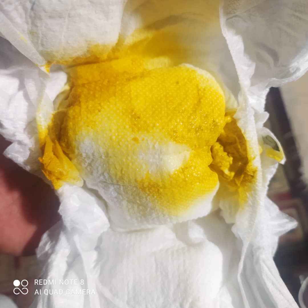 دکتر در مورد شیر و دفع پسرم +عکس