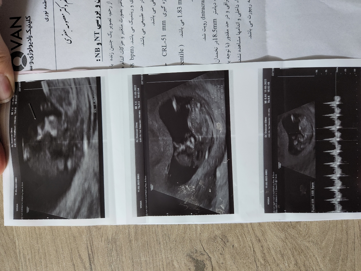 جواب ازمایش غربالگری اولیه و آزمایش چکاپ