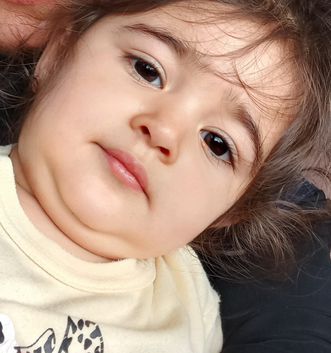 دونه زیر چشم کودک