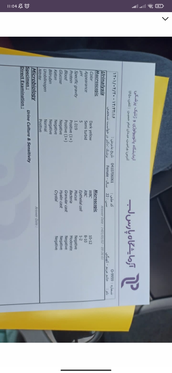 بوی بد ادرار بعد از خوردن دوفاستون بوی بد ادرار بعد از خوردن دوفاستون