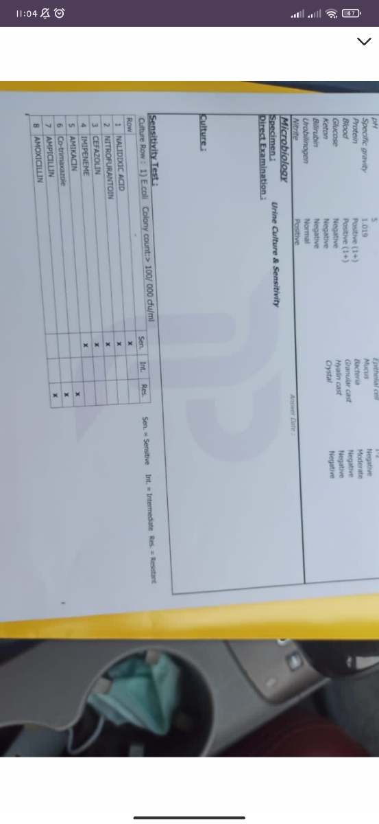 بوی بد ادرار بعد از خوردن دوفاستون بوی بد ادرار بعد از خوردن دوفاستون