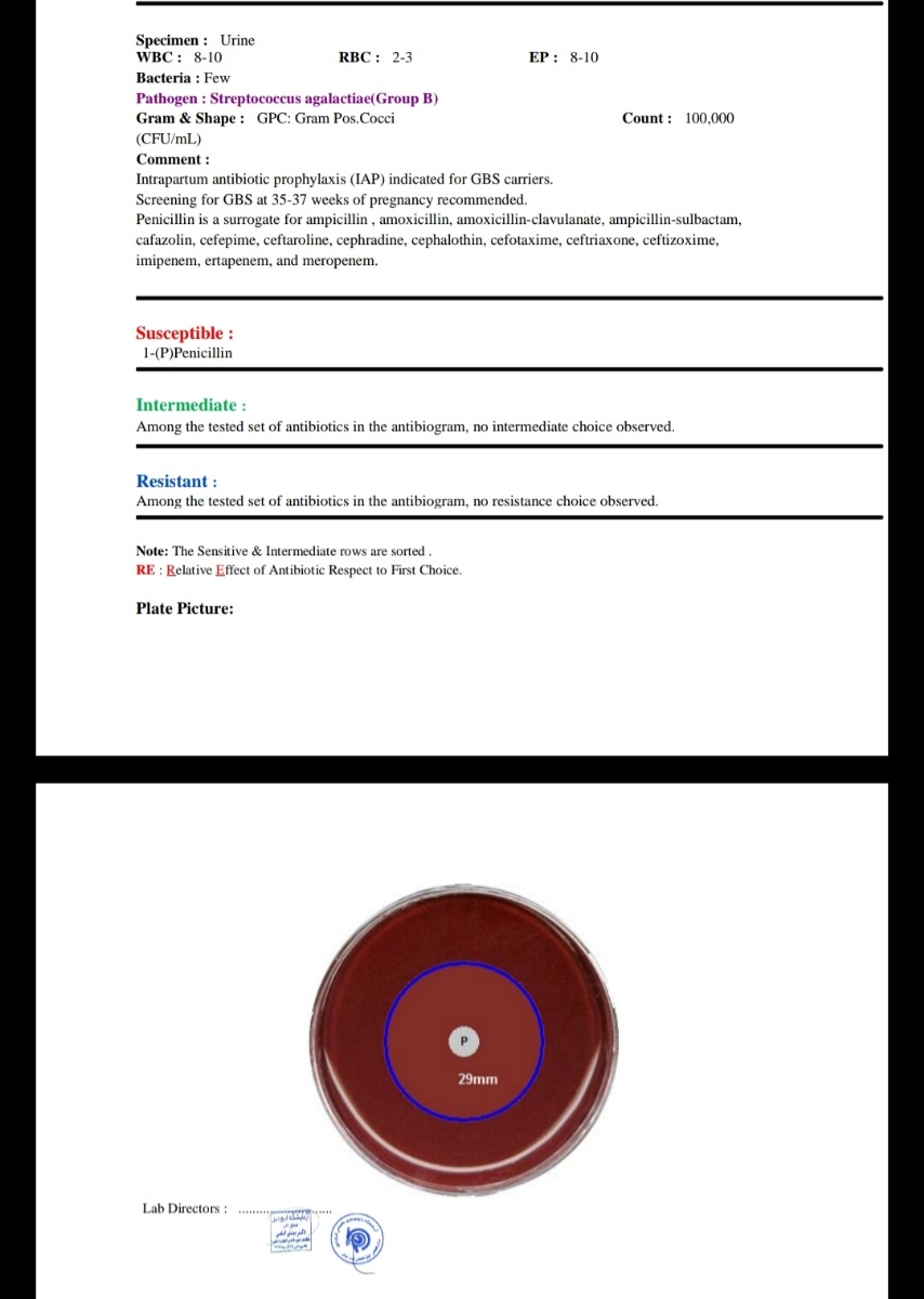 تفسیر جواب آزمایش بارداری تفسیر جواب آزمایش بارداری