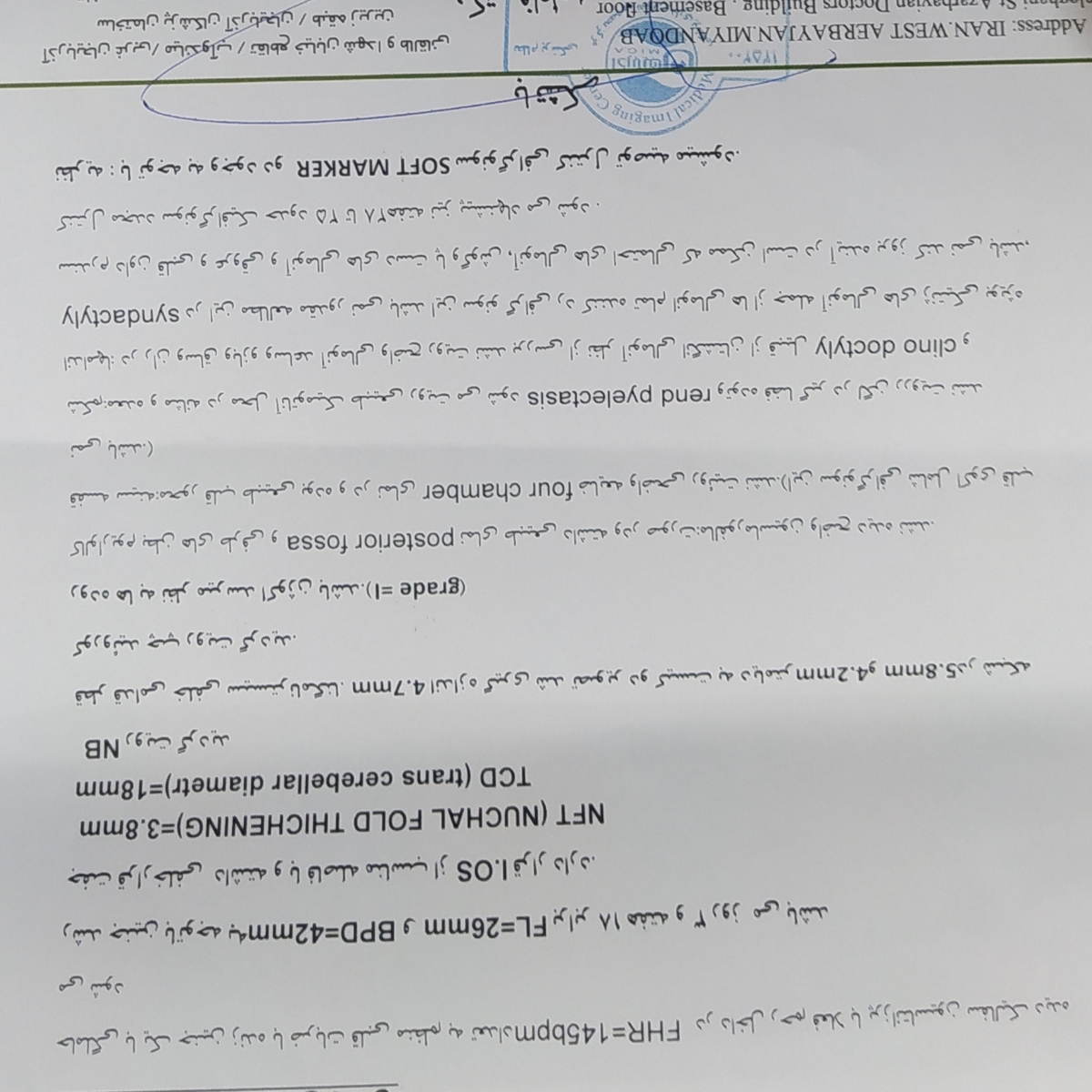 کیست شبکه کوروئید واکوژن روده گرید ۱ کیست شبکه کوروئید واکوژن روده گرید ۱