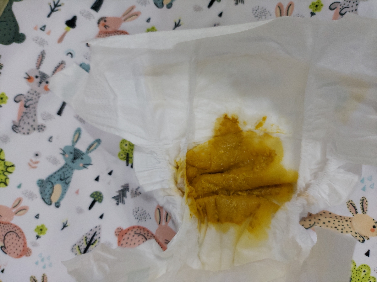 مدفوع شل و زرد رنگ مدفوع شل و زرد رنگ