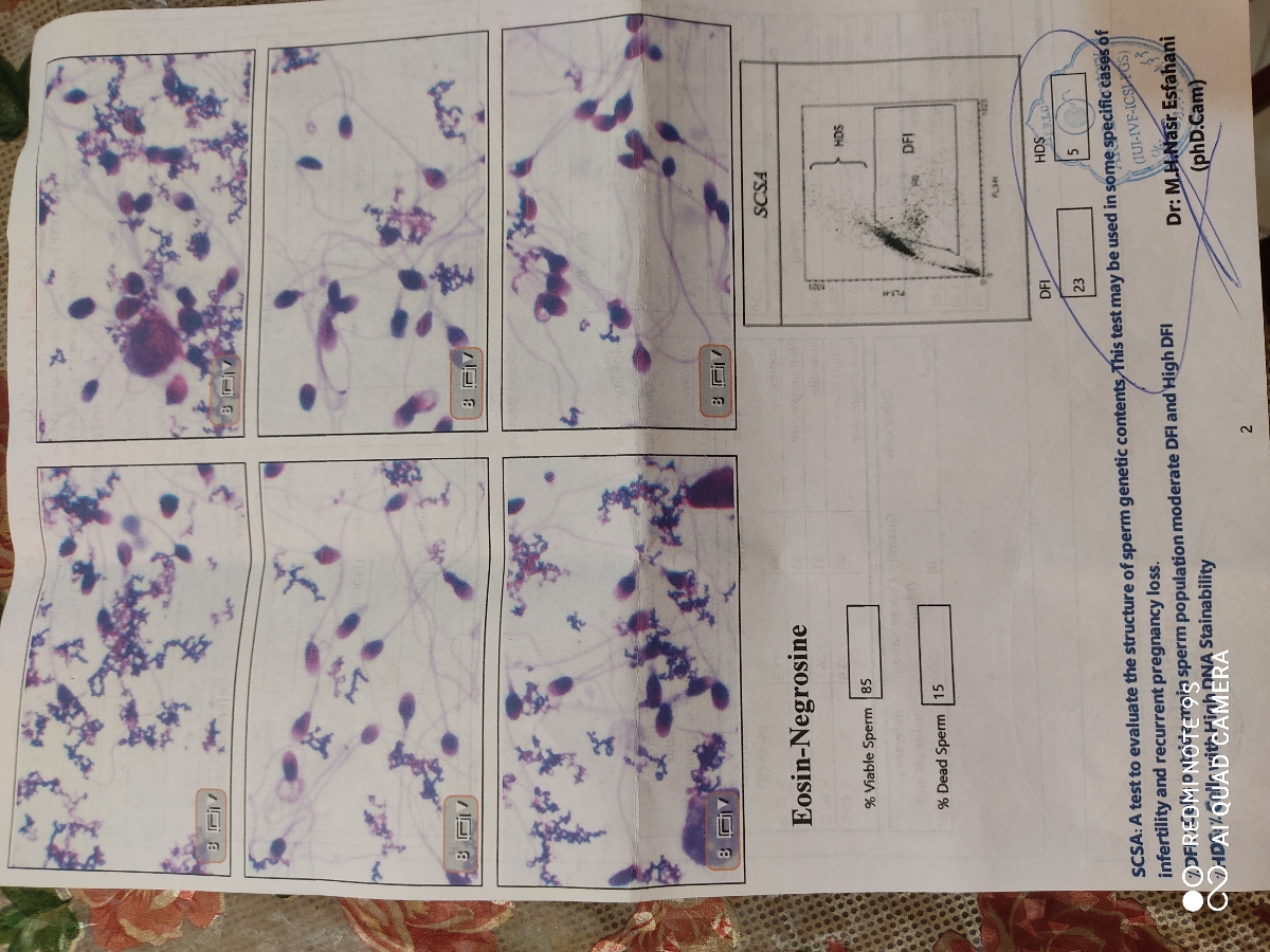 تفسیر ازمایش اسپرم همسرم
