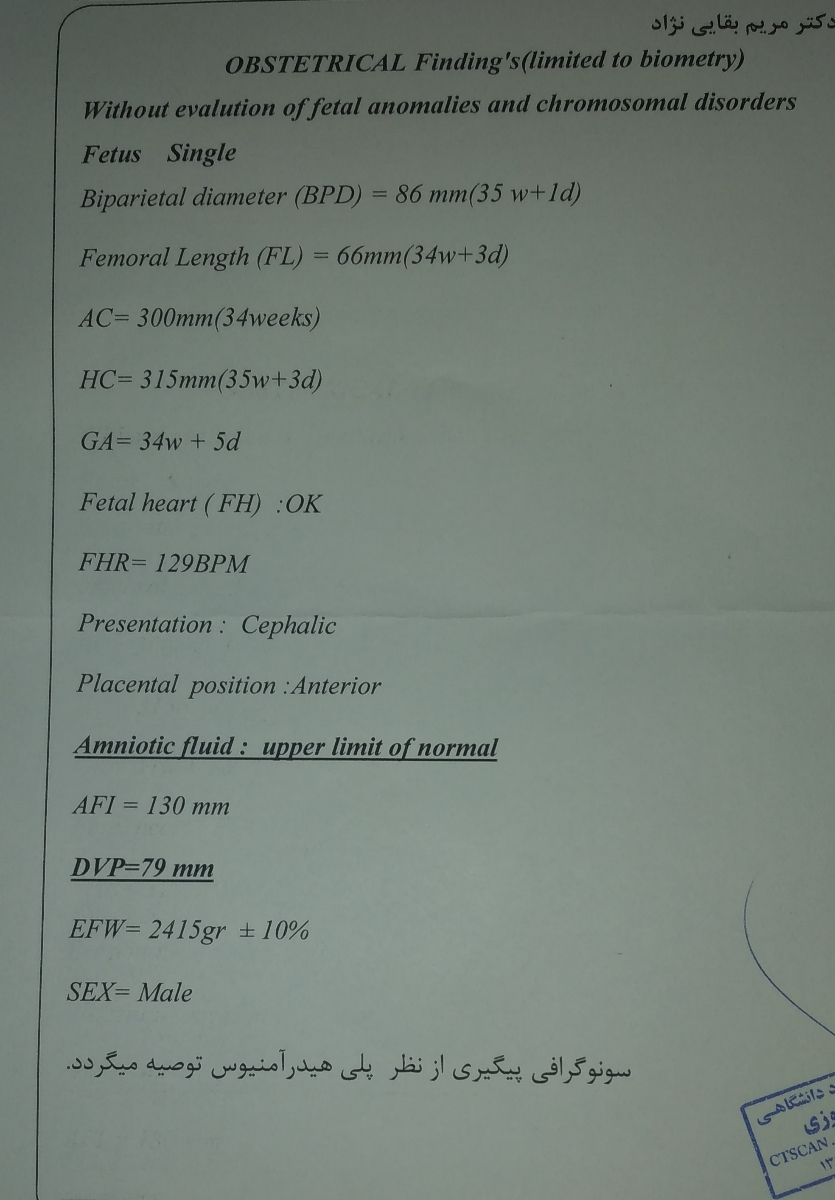 این پایین نوشته نمیدونم کدومشونه دقیقا این پایین نوشته نمیدونم کدومشونه دقیقا