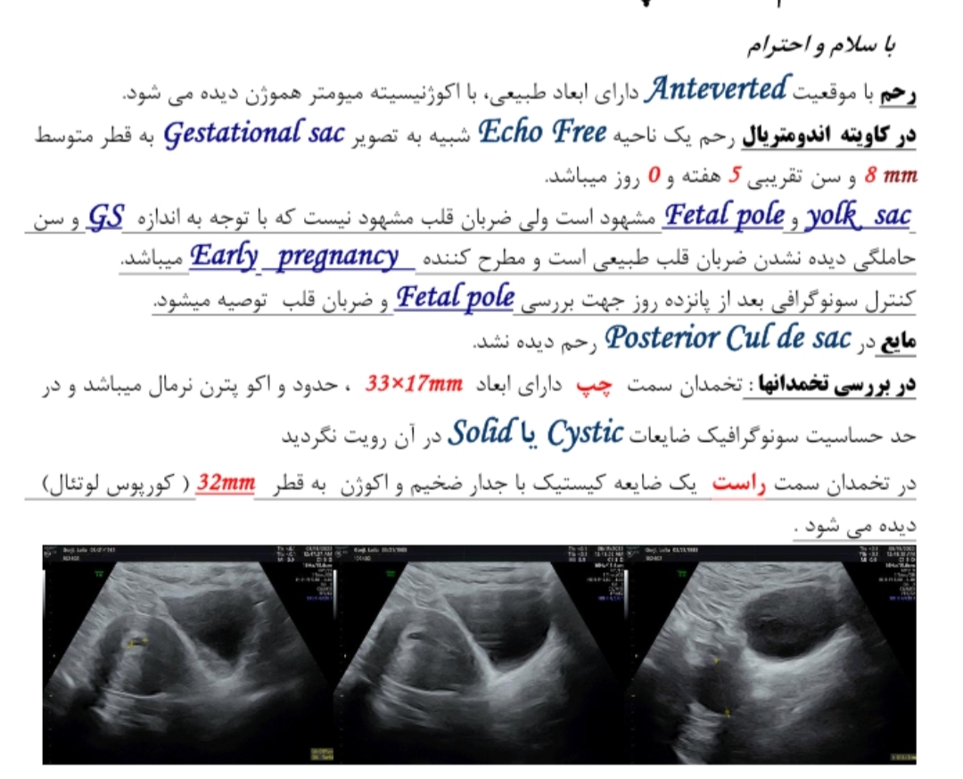 لکه بینی هفته ی پنجم لکه بینی هفته ی پنجم