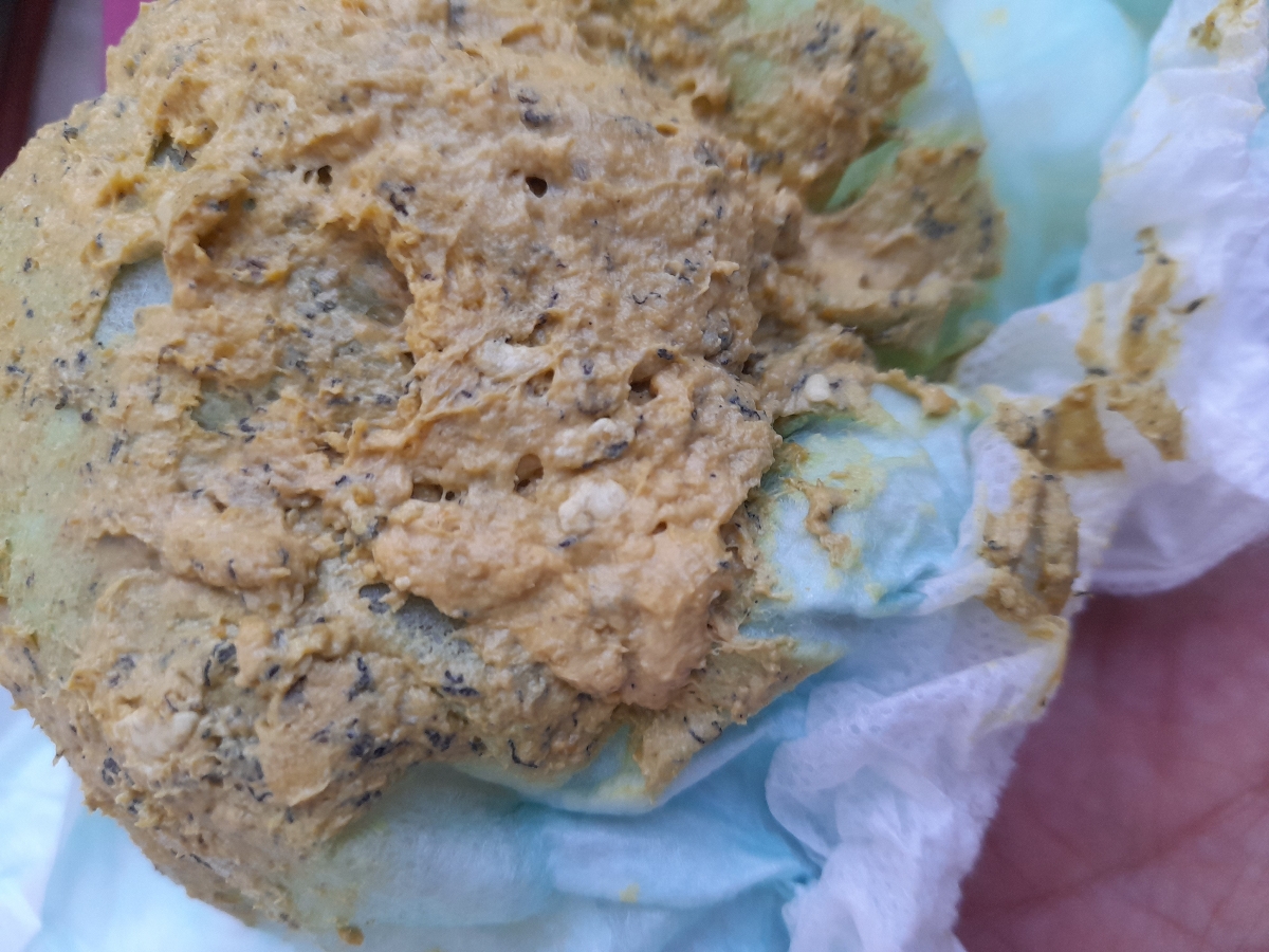 تغیر مدفوع پسرم(همراه با عکسه، لطفا اگر اذیت میشین تاپیکو باز نکنید) تغیر مدفوع پسرم(همراه با عکسه، لطفا اگر اذیت میشین تاپیکو باز نکنید)