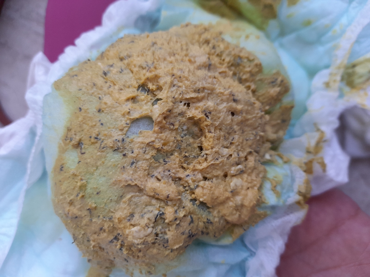 غذای کمکی و تغیر مدفوع( همراه با عکسه لطفا اگر بدتون میاد تاپیکو باز نکنید) غذای کمکی و تغیر مدفوع( همراه با عکسه لطفا اگر بدتون میاد تاپیکو باز نکنید)